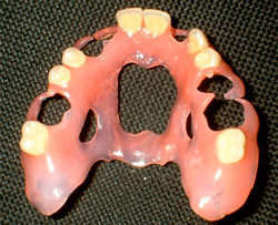 Гнучкі знімні зубні протези